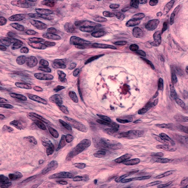 Microscopic photo an egg